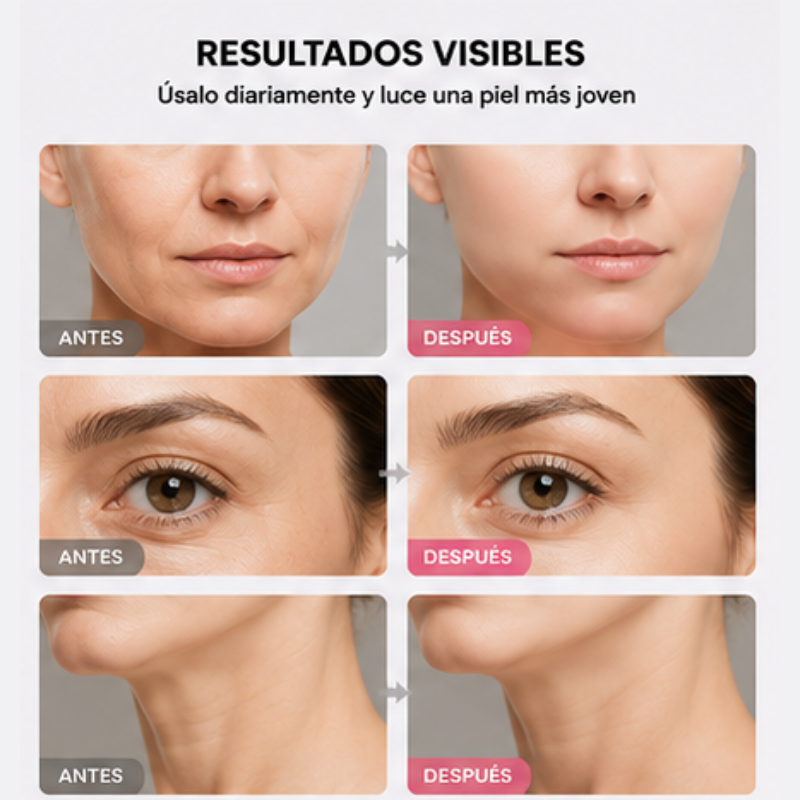 Masajeador Facial Lifting EMS
